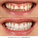 096期开奖号码震撼揭晓,幸运数字花落谁家? og6fvwh5